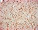 Calretinin immunostaining
