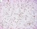 CD34 immunostaining