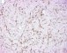 CD34 immunostaining