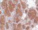 Plexiform schwannoma (S100)