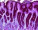 Normal ABPAS in stomach