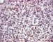 Myogenin immunostaining