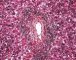Periportal hematopoiesis (Fetus, 32 weeks)