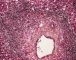 Periportal hematopoiesis (Fetus, 32 weeks)