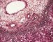 Periportal hematopoiesis (Fetus, 32 weeks)