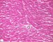 Normal cardiomyocytes