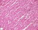 Normal myocardium
