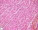Normal cardiomyocytes
