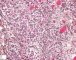 Fetal ovary 25 weeks