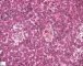 Fetal liver 25 weeks
