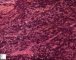 Precursor B lymphoblastic lymphoma