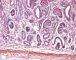 Renal tubular dysgenesis