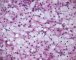 Xanthogranulomatous reaction in osseous Langerhans histiocytosis