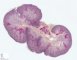 Fetal kidney at 20 weeks