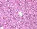 Fetal liver 21 weeks