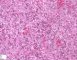 Fetal liver 21 weeks