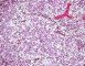 Fetal ovary (22 weeks)