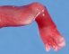 Foot oligodactyly