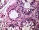 Digestive GVH