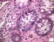Digestive GVH