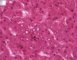 Glycogenic nuclei in hepatocytes