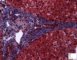 Lipofuscin in portal macrophages