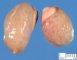 Renal dysplasia in Meckel syndrome (15 weeks)
