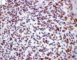 Desmin immunostaining
