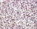 Myogenin immunostaining