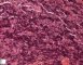 Precursor B lymphoblastic lymphoma
