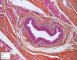 Thyroglossal tract