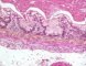 Fetal colon 24 weeks
