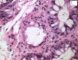 Colonic GVH