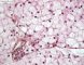 Hepatic glycogenosis (HPS)