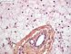 Hepatic glycogenosis (HPS)