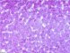 PAS coloration of hepatocytic cytoplasm (before diastase)