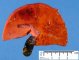 Hepatic ischemia in a systemic sepsis