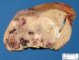 Hepatoblastoma (after formalin fixation)