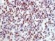 Desmin immunostaining
