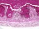 Fetal colon 24 weeks