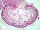 Fetal kidney