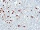 Cytokeratin immunostaining