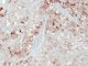 EMA immunostaining