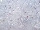 INI1 immunostaining
