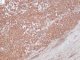 Vimentin immunostaining