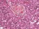 Fetal liver 25 weeks