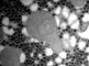 Abnormal mitochondria