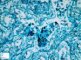 Fetal candida pneumonitis.