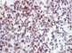 Desmin immunostaining
