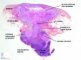 Mycobacterial adenitis with fistulisation to the skin - HE.